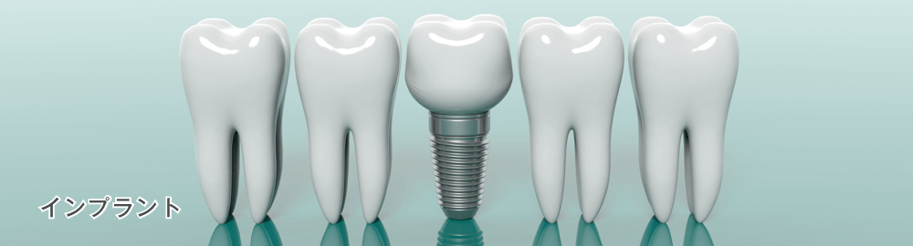 インプラント
